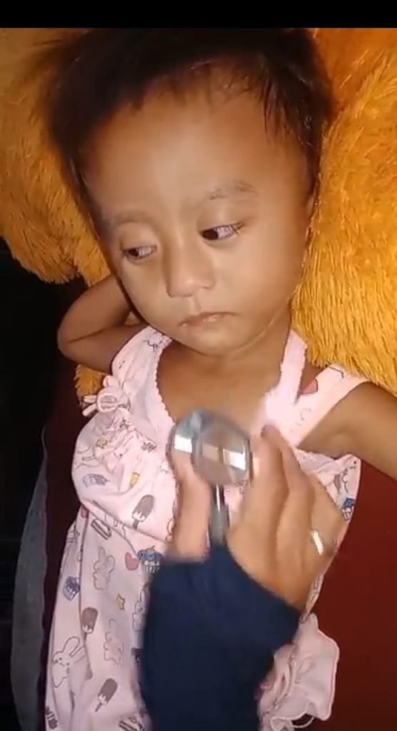 JIhan Penderita Gizi Buruk